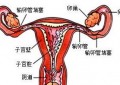 输卵管堵塞哪种最严重,识别并应对最严重的症状